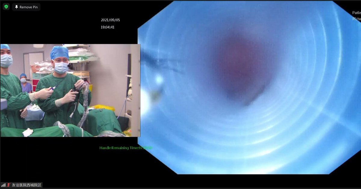 yeowyy's tweet photo. Had a fruitful morning of discussion and live surgery with the amazing team at Beijing Friendship Hospital and Drs Arun and Nguyen from Malaysia and Vietnam.
3 cases of fURS completed in 30 minutes each, demonstrating the resolution of the #Innovex #EUScope. https://t.co/csvlrcKUUL