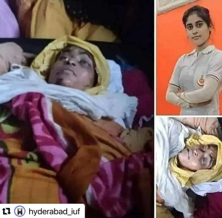 RazzaqueShaik16's tweet photo. Disturbed ,Angry, upset , shocked if this the condition of a civil defense officer in our country then what is the security or safety for our indian women. All this is happening in the capital of our great powerful nation.? Why is the delhi police silent.#JusticeForRabiya #Delhi https://t.co/54eBxyhpe9
