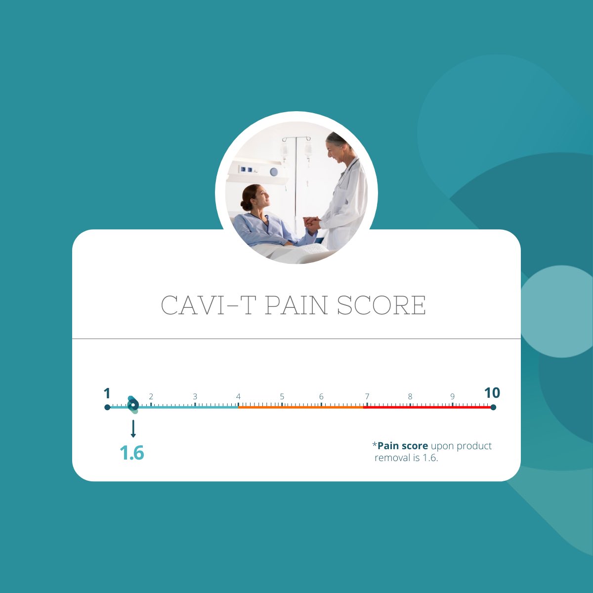 ↘️ The pain score upon removal for our CAVI-T treatment is 1.6/10 on a VAS (visual analog scale).

👃🏼 Upon removal the product doesn't stick to the mucosa, thus causing less pain for the patient.

To learn more about CAVI-T  👉🏼 bit.ly/3n6wuLa 

#epistaxis #treatment #ORL