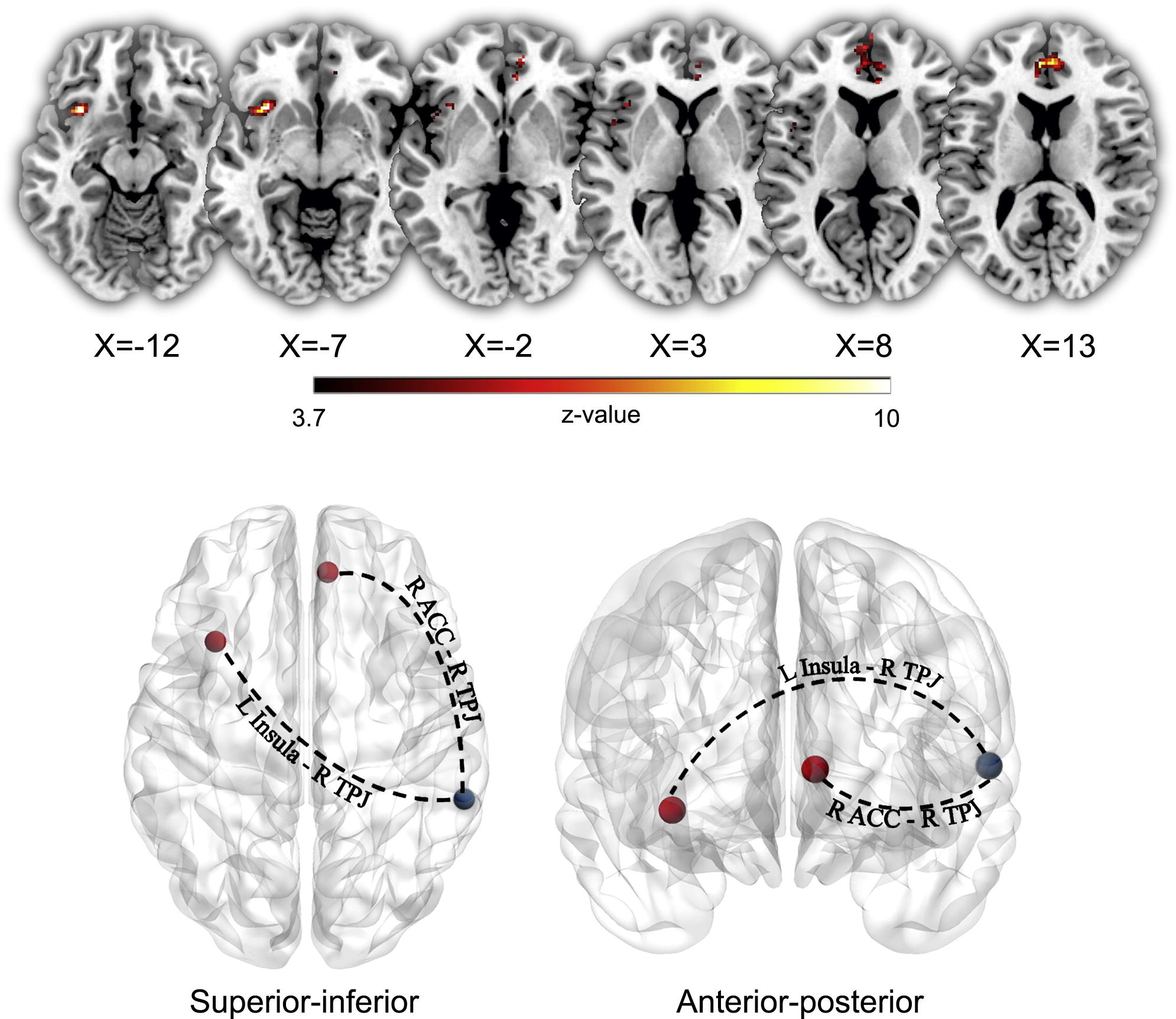 IFCN and its Clinical Neurophysiology journals on Twitter "[Visual
