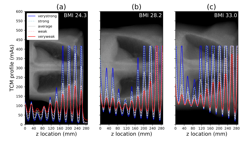 DukeCVIT's tweet photo. We have developed and validated a framework to apply tube current modulation in our #DukeSim simulations. This enables #VirtualImagingTrials with more clinically relevant features. @DukeRadiology @DukeEngineering @DukeMedPhys @DukeRAILabs Read more: https://t.co/TrV3RTjUKy https://t.co/oDD38pYDYY