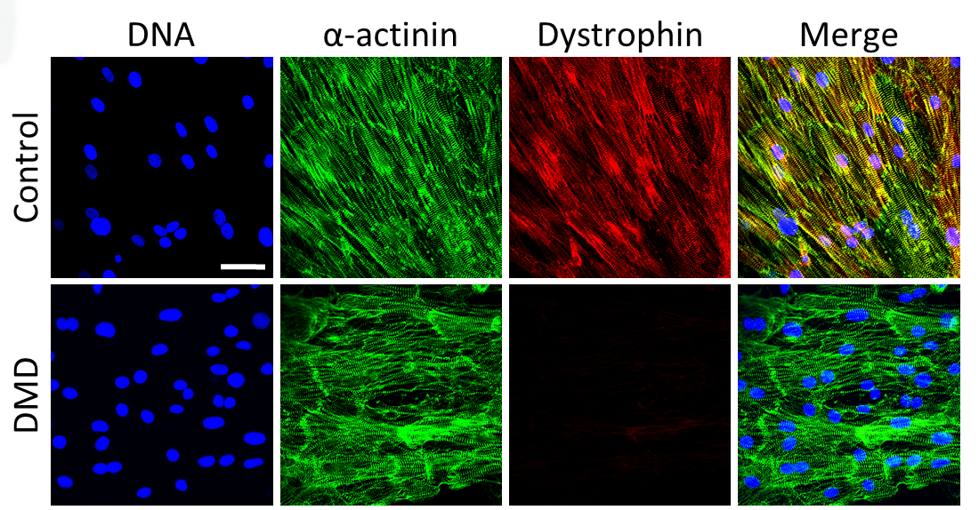 CircRes's tweet image. Atmanli &amp;amp; colleagues found that #dystrophin correction attenuates #DMD associated cardiac #transcriptional dysregulation. Learn how #GeneEditing normalizes structural and morphological abnormalities ow.ly/ayDS30rSKNf

@lab_olson @MiaoCuiUTSW @Transactivator