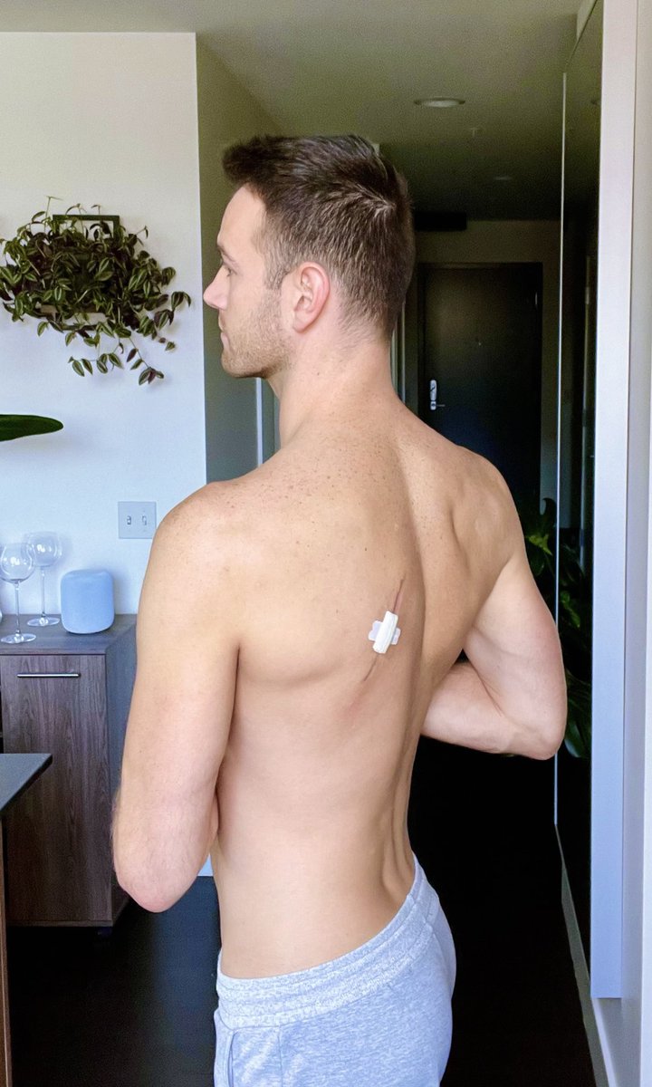 Scars are sexy, right?