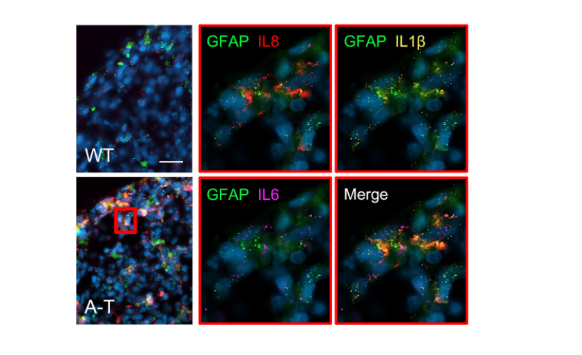 Using #BrainOrganoids 🧠 , researchers find that increased cGAS and STING activity is an important contributor to chronic inflammation and premature senescence in the central nervous system of ataxia-telangiectasia.
bit.ly/38LWDXp