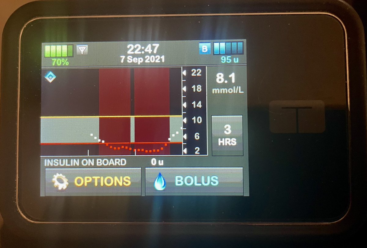 CambsBridge's tweet image. That was a BAD one. Fits of hysteria and refusing to eat. 😳😤😕
First time my #tslim (#dexcom) has ever registered ‘LOW’. The beeping noises were so loud and persistent! 
#GBDoc #T1D #T1Diabetes #hypo #low 
All good now! 👌🏼