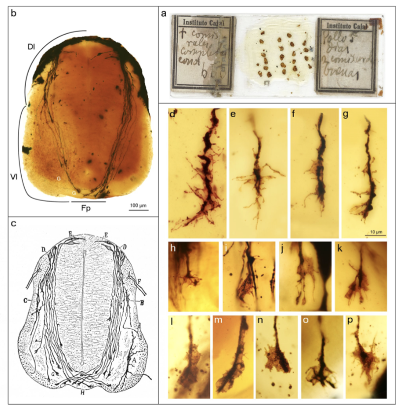 artinthelab's tweet photo. Found this re-imaging of #Cajal's slides commissural #neurons and #GrowthCones for recent @dana_fdn #artinthelab. Beautiful! #drawing #neuroscience García-Marín et al 2009 The Growth Cone as Seen Through Cajal’s Original Histological Preparations doi: 10.1080/09647040801961430. https://t.co/kt1s0LoQbK
