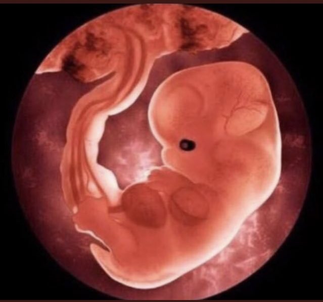 Sexo Seguro El Aborto Es Quitarle La Vida A Una Persona Que Aunque Sea Muy Pequena Es Persona Ella Posee Todo Su Material Genetico Y Autonomia Pues Por Si Sola