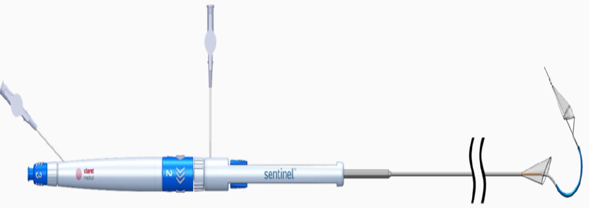 Vessel_Plus's tweet image. #ProtectionDevices #TAVI Good article sharing &quot;Routine use of cerebral protection devices during transcatheter aortic valve implantation: what does the evidence say?&quot;
@ozkr_millan @rafasadaba @ernestocardio @FabriziougoMD @GreggWStone 
Download free👇
vpjournal.net/article/downlo…