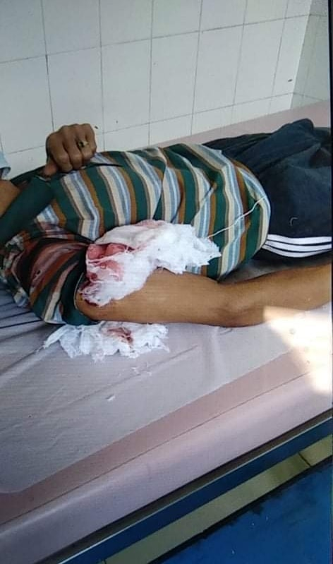 ChindwinPost's tweet photo. One civilian wounded and many houses destroyed as the military fired shell indiscriminately in Chin state's capital Hakha on Yesterday night around 10:00pm according to residents. "They fired shell indiscriminately after hearing gunfire and explosions" a resident told us. https://t.co/rxOUVuO8dn