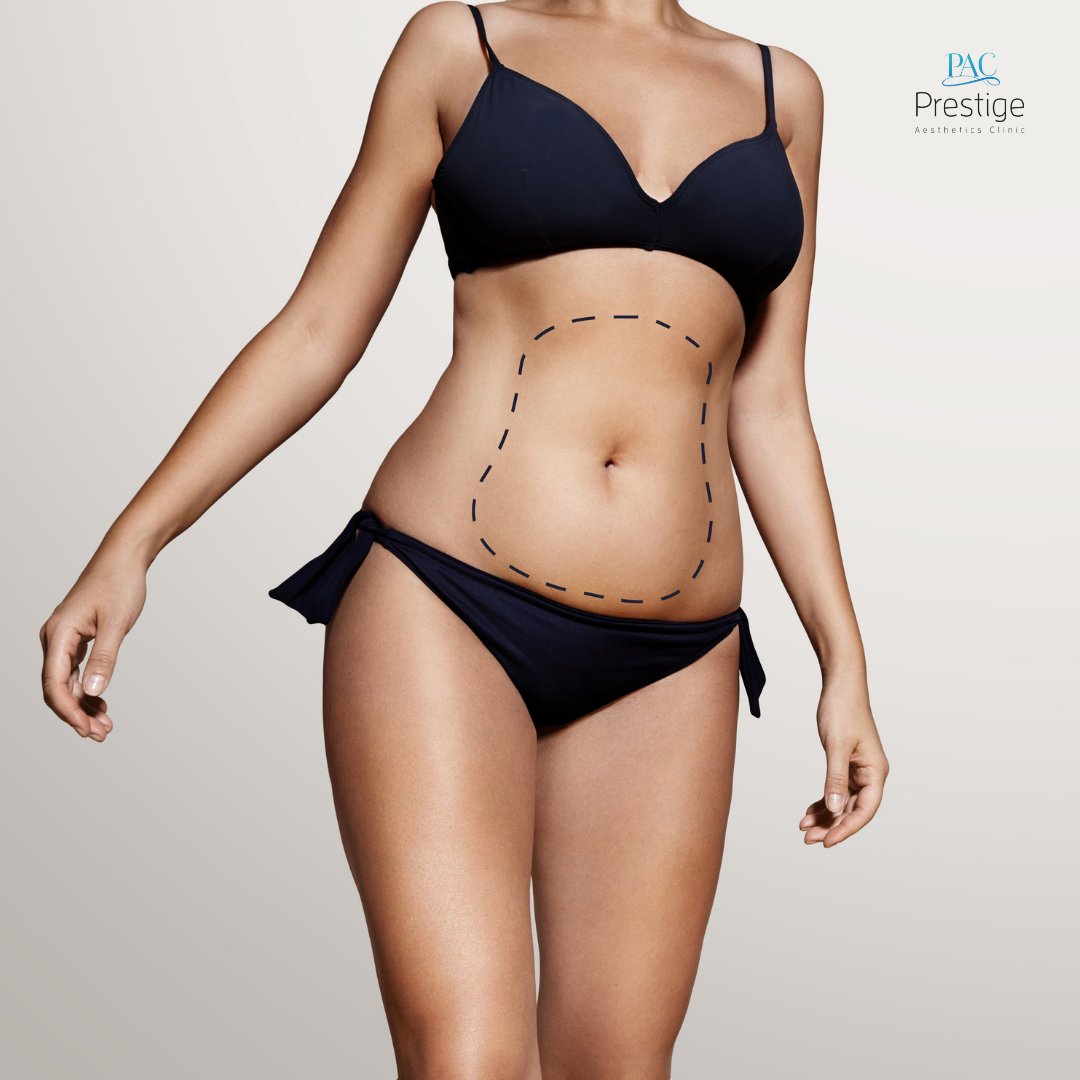 pacboca's tweet image. A flat stomach is achievable with stomach liposuction! This procedure can sculpt and shape your abdomen while maintaining your curves elsewhere. Schedule your appointment 👉 bit.ly/2RjTnNL

#liposuction #medspa #confident #beauty #bocaraton #antiaging #bocamom
