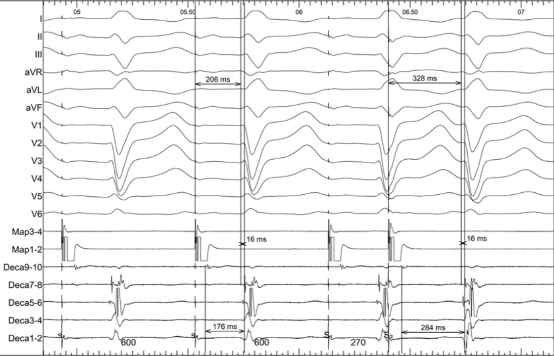 James Elliott tweet media