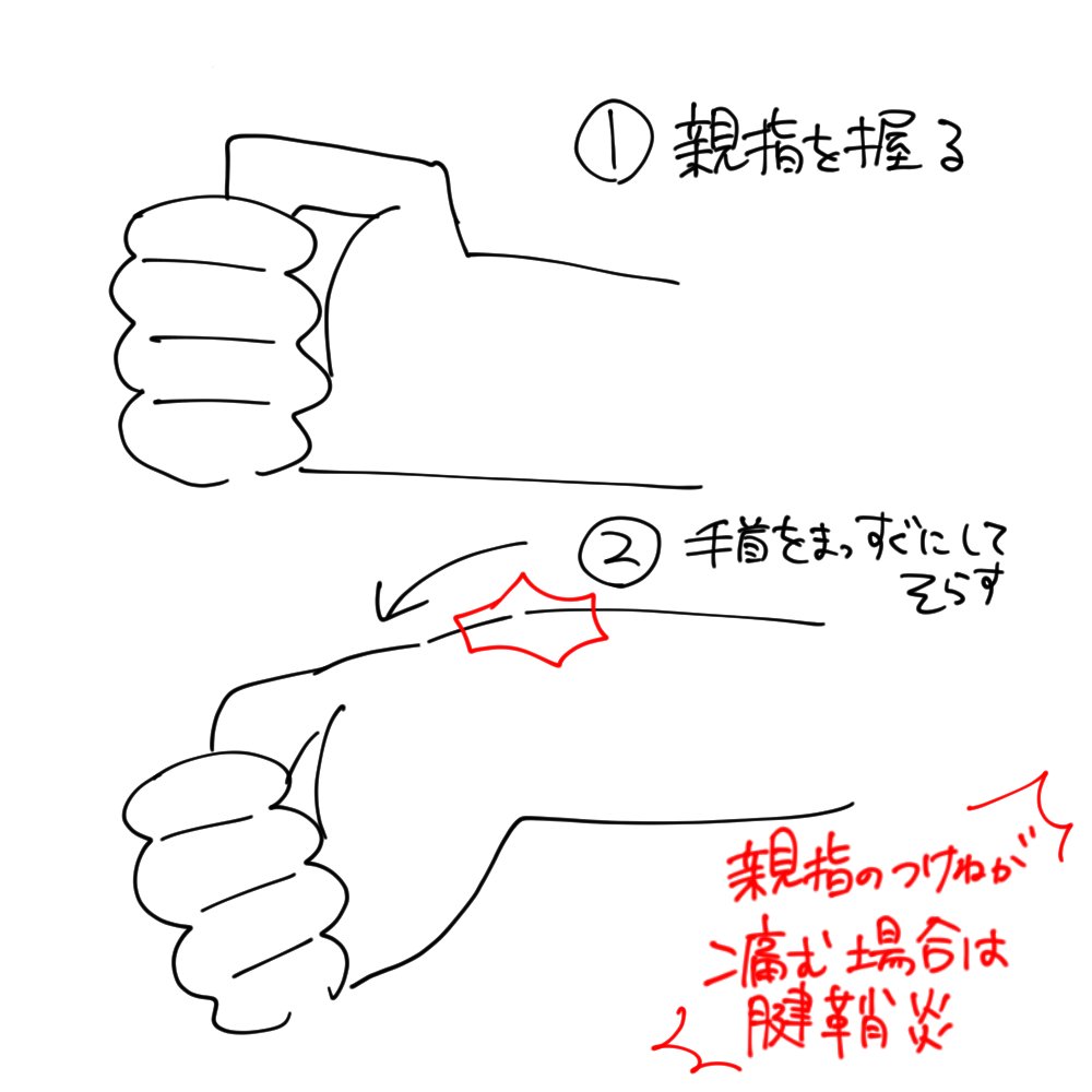 最近手首痛くて腱鞘炎チェックしたら糞痛くてめっちゃ笑った これ痛くない人いるの!?!?!? 