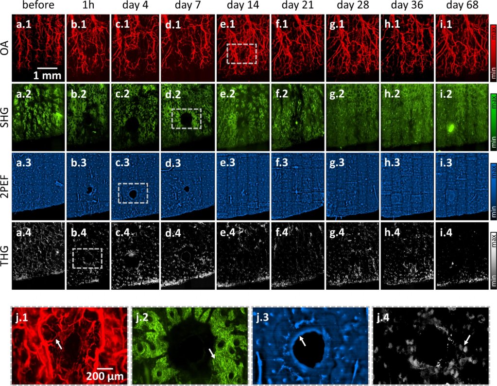 Communications Biology (@commsbio) on Twitter photo @seegermarkuset <a href="/ntziachristos/">Vasilis Ntziachristos</a> <a href="/ChristophDehner/">Christoph Dehner</a> & <a href="/DominikJuestel/">Dominik Jüstel</a> offer unique insight into the wound healing process in mice with Co5M microscopy. Their method yields multiple simultaneous parameters of pathophysiological processes in a label-free mode.
nature.com/articles/s4200… @seegermarkuset <a href="/ntziachristos/">Vasilis Ntziachristos</a> <a href="/ChristophDehner/">Christoph Dehner</a> & <a href="/DominikJuestel/">Dominik Jüstel</a> offer unique insight into the wound healing process in mice with Co5M microscopy. Their method yields multiple simultaneous parameters of pathophysiological processes in a label-free mode.
nature.com/articles/s4200…