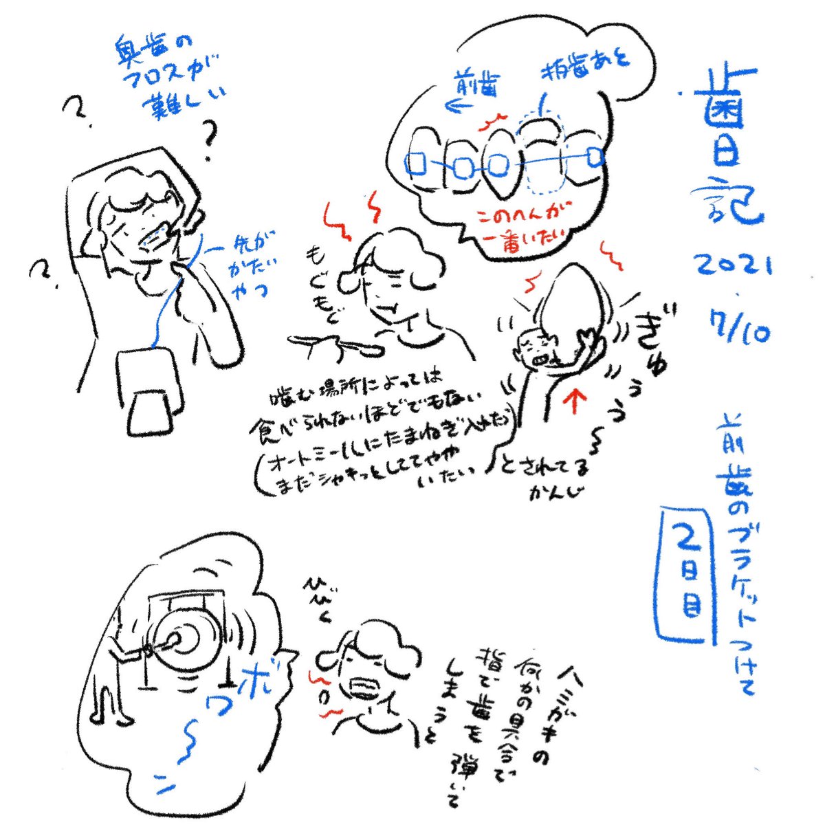 [歯日記まとめスレッド]1〜4 #オカヤ歯日記 