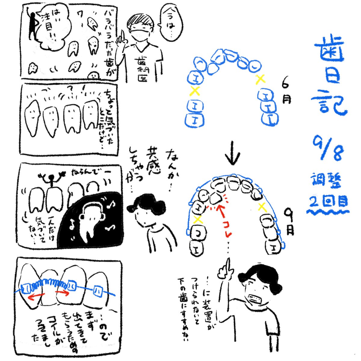 9 #オカヤ歯日記 