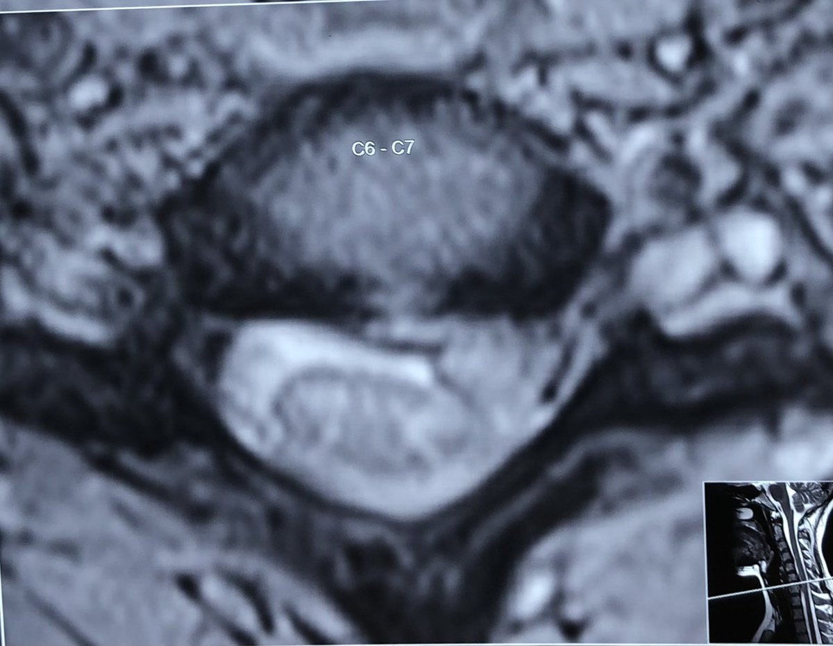 advancedspine20 tweet picture