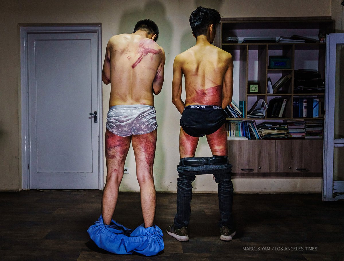 Powerful photo by @yamphoto of the two journalists who were detained, tortured and beaten by the #Taliban yesterday in #Kabul.