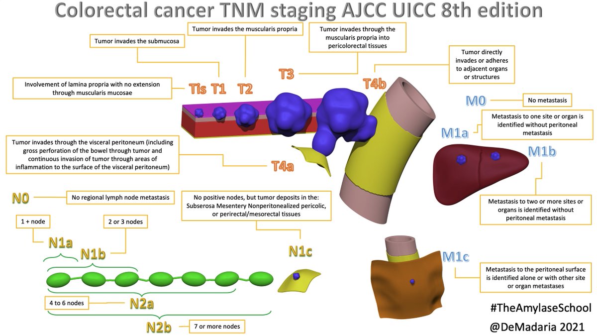 Visual guide to Colorectal cancer #TNM staging AJCC UICC 8th edition, a #TheAmylaseSchool infographics #UEGambassador #HiloAEG @my_ueg @aegastro @Rodrigus01 @castells_toni @frankbalaguer @MoreiraR_Leti @JoaquinCubiella @aecirujanos @_SEOM @Baricorcho @almagoch @Vilavaite
