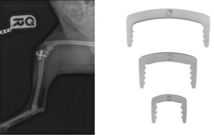 infinitimedical's tweet photo. Two new orthopedic products have been added to the Infiniti Medical Family!
- MINI Staples, perfect for those even smaller MMP cases
- 1.5mm, 2.0mm, and 2.5mm drill stops that allow for precise pre-measured drilling.
Contact for more info! info@orthomedusa.com https://t.co/OaqGyWffdb