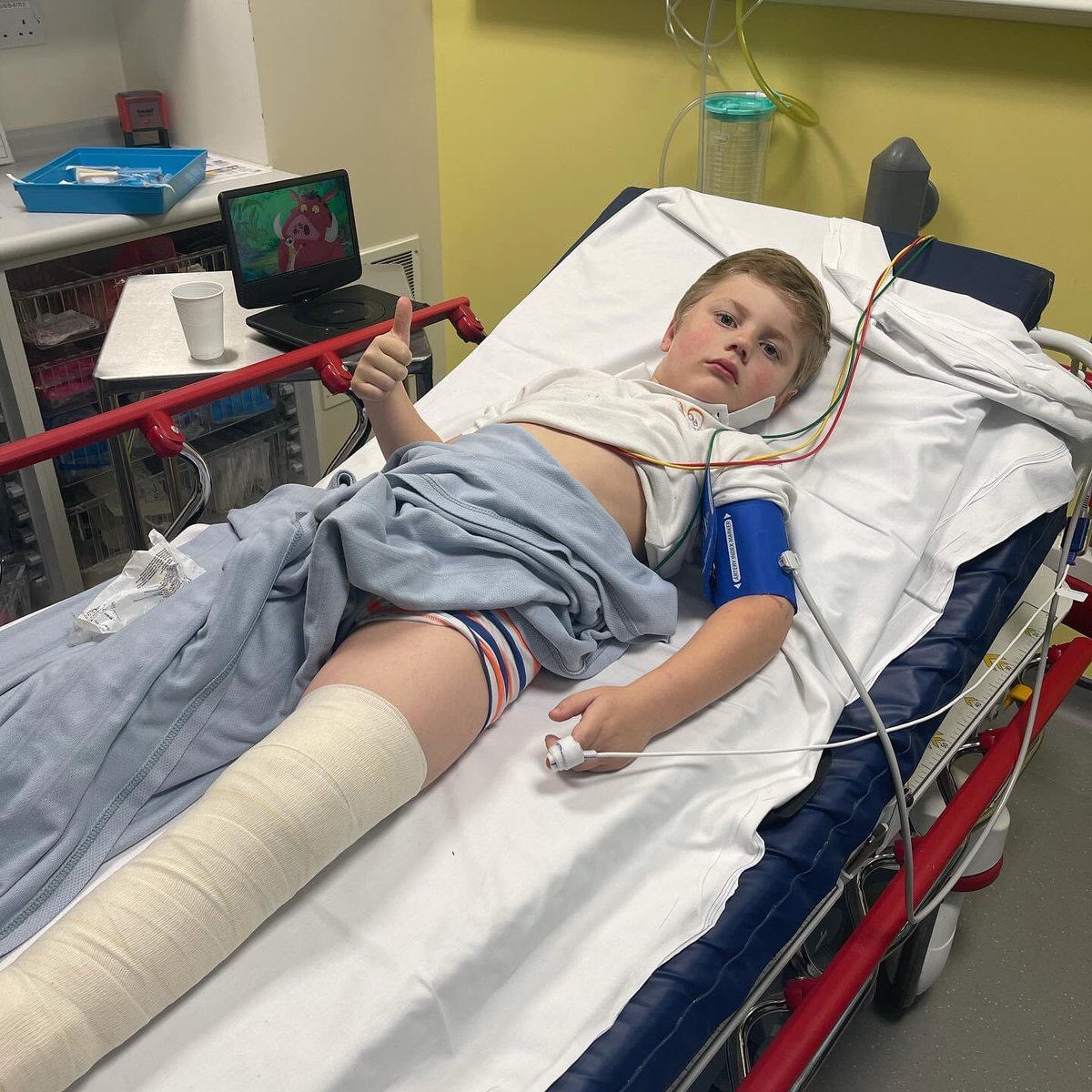 Dannyhughes37's tweet photo. My Son broke his leg today :( https://t.co/W2Jns5H5xN
