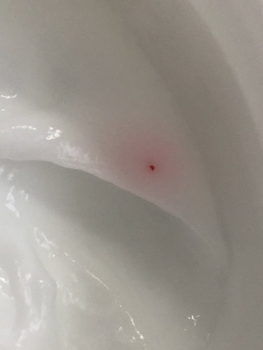 dangi_dkan's tweet photo. @cerave I am using cerave for years and never had any problem but this time I bought  it from Costco and found this .very disappointed https://t.co/wOPjvdyJmF