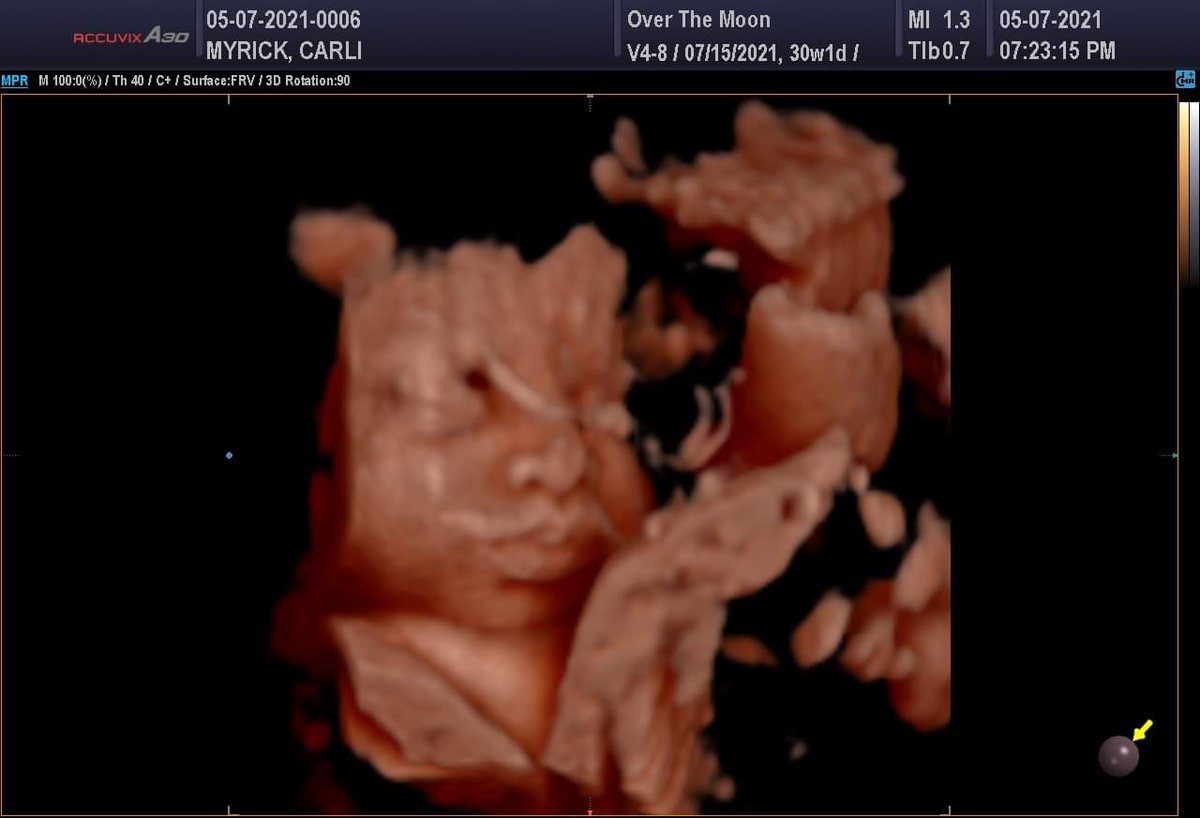Just look at our sweet baby 🥺
I am so in love with him.