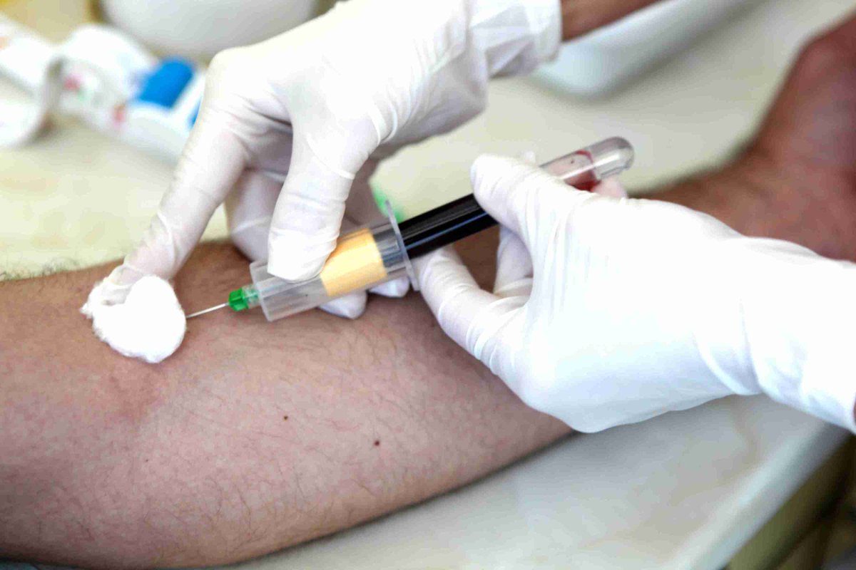 Serum Bile Acid Test
healthcarentsickcare.com/bile-acid-test
#bileacid #bileacidtest