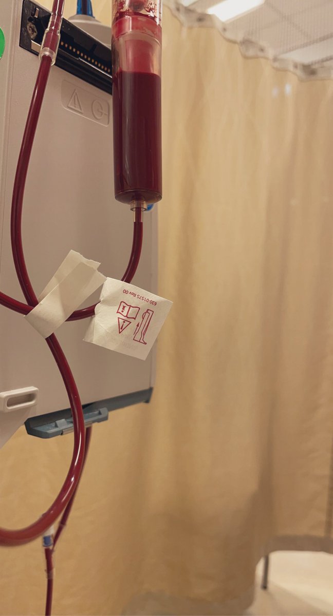 يحتاج مريض #الثلاسيميا الكبرى إلى نقل الدم بإستمرار للمحافظة على الهيموجلوبين وان يعيش حياة طبيعية خاليه من الألم. 

لذلك نحث الجميع على أهمية التبرع بالدم لإنقاذ مرضى الثلاسيميا 🩸❤️

#اليوم_العالمي_للثلاسيميا
#الوراثة_الطبية