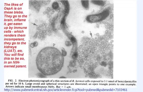 A common misconception (happily perpetuated by the  #LymeMafia) is that *poof!* the OspA magically disappears & is replaced by OspC. Incorrect. Borrelia do this thing called blebbing. It’s the release of exosomes covered in Osps. See the “fish eggs?” #LymeDiseaseAwarenessMonth 4/