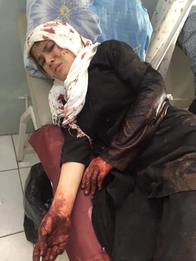 vatantoday's tweet photo. Continuation of #HazaraGenocide

After 130 years from the Abdurrahman Khan era that mass murdered 62% of the total population of Hazaras and given their lands to Pashtun nomads, Hazaras are still under attack.

Photos are from todays attack
#Kabul #Dasht_e_Barchi
#کابل
#دشت_برچی https://t.co/27hyYHnxRE