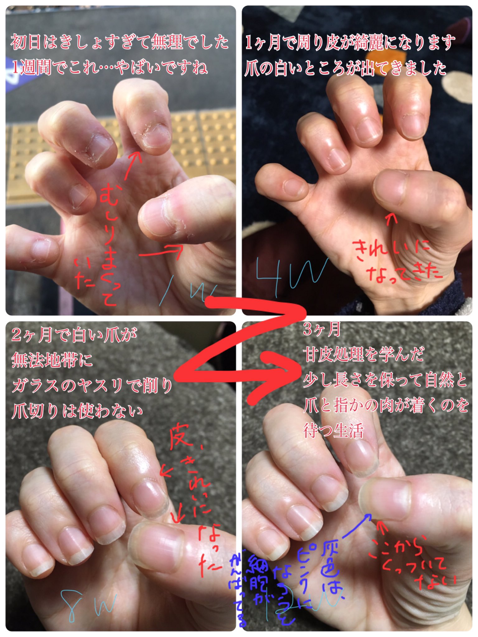 夢露 深爪注意 まともに爪を伸ばしたことなく 皮や爪 をひたすらむしりたくなる衝動を抱えて生きてきた人が 半年間むしりたくなったらオイルを塗って育爪した結果まとめ 汚いです 毎週土曜日に写真を撮って 思い立った日が土曜だった
