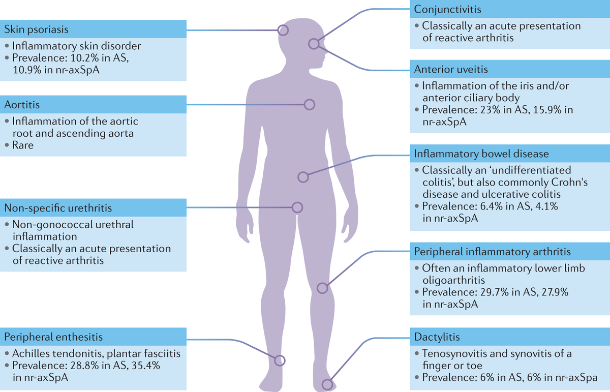 NatRevRheumatol's tweet photo. Axial spondyloarthritis: concept, construct, classification and implications for therapy

Catch up on your #axSpA reading this #WorldASDay

https://t.co/jfYlU2l13O https://t.co/Ja2SJbXWaC