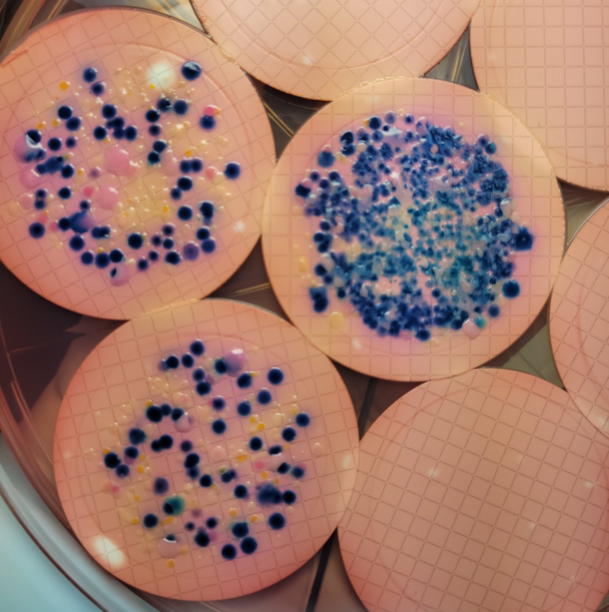 shinybabyb's tweet photo. Adding some culture to my feed today.
#Microbiology #labhumour #tweetsfromthelab #bacteria https://t.co/SuHYDHsHZn