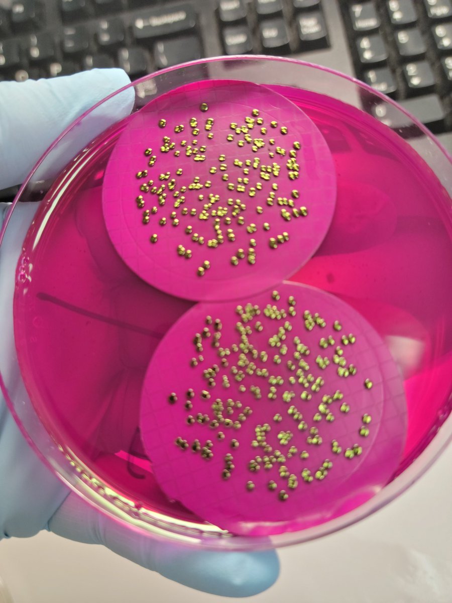shinybabyb's tweet photo. Adding some culture to my feed today.
#Microbiology #labhumour #tweetsfromthelab #bacteria https://t.co/SuHYDHsHZn