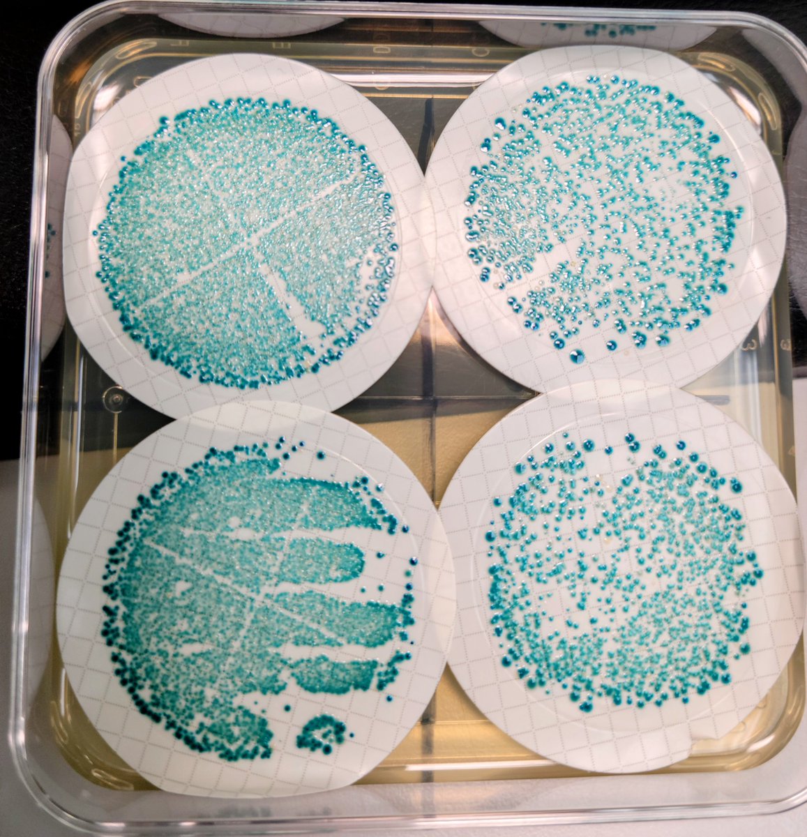 shinybabyb's tweet photo. Adding some culture to my feed today.
#Microbiology #labhumour #tweetsfromthelab #bacteria https://t.co/SuHYDHsHZn