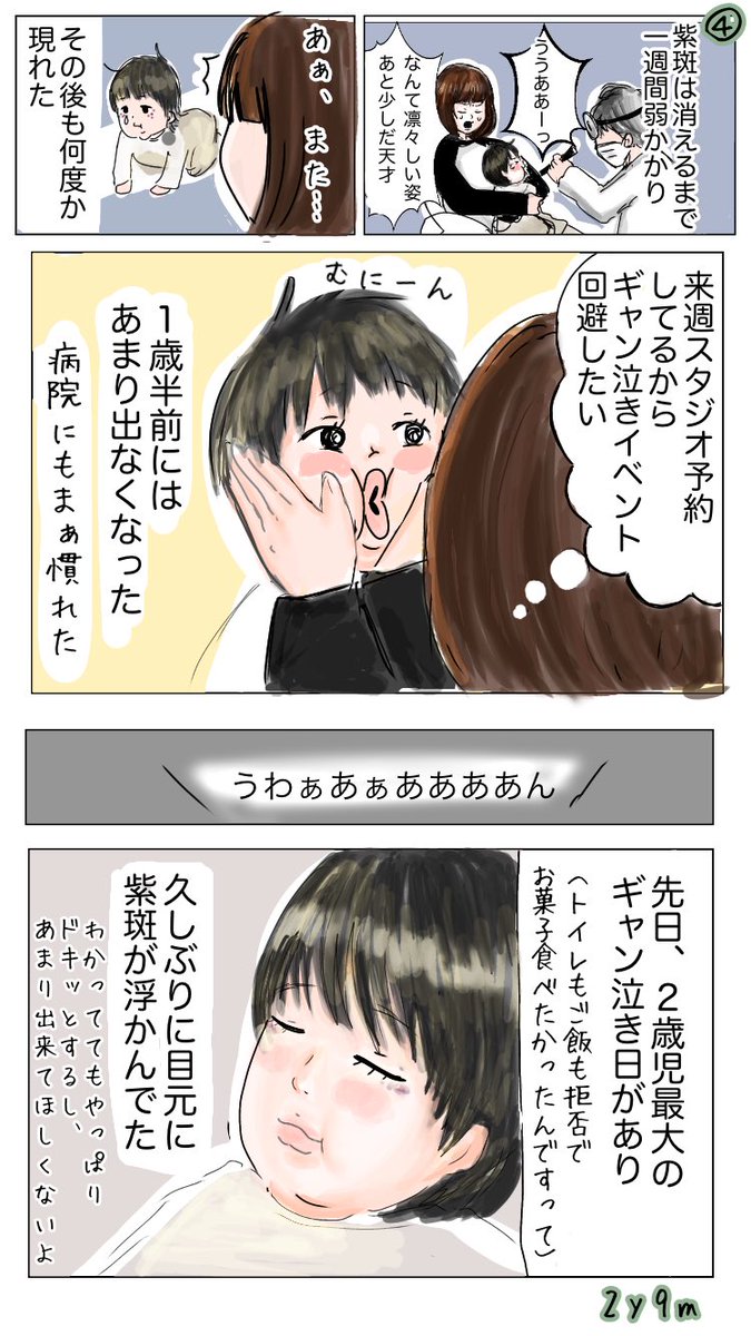 おしそ 初めて耳鼻科を受診した後 こどもの顔に紫斑が出た時のこと 育児絵日記 育児漫画 エッセイ漫画 おしそ 初めて耳鼻科を受診した後 こどもの顔に紫斑が出た時のこと 育児絵日記 育児漫画 エッセイ漫画