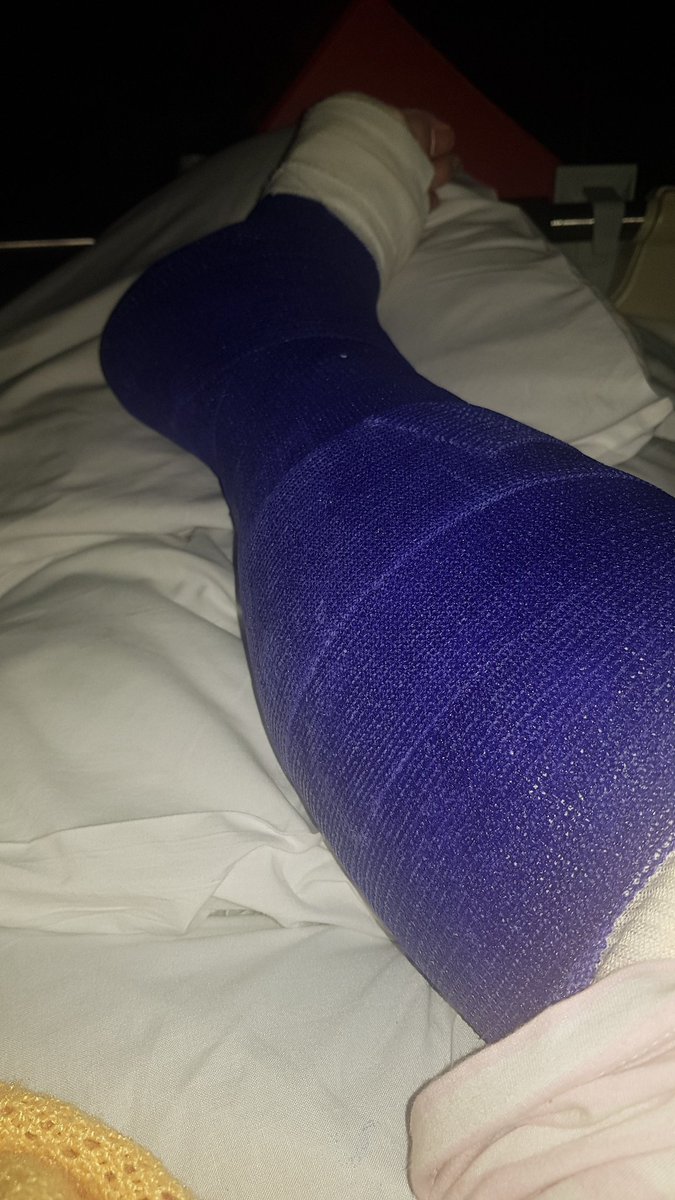 amy1989hope's tweet photo. In hospital with a fractured ankle !! When I get home I'm thinking I need to buy some @TheTigerGin to keep me company for the next 12 weeks!! #gin #tigergin #gintherapy #longrecovery #bedbound https://t.co/8Cnfr9BQNX