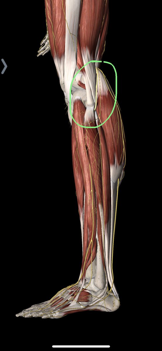 2/ You prolly already know this, but just in case....The common peroneal nerve is an extension of the Sciatic nerve, and passes behind the head of the fibula through an opening in the origin of the peroneus longus muscle.