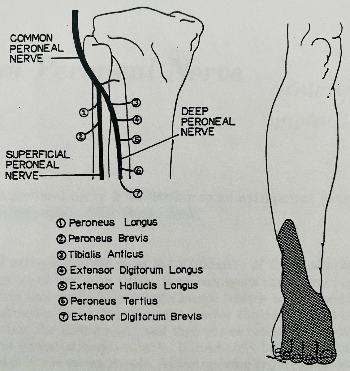 4/ Common (root) Peroneal Nerve supplies:• ankle dorsiflexors muscles• foot/ankle eversion muscles• sensation along lateral > anterior aspects of knee, ankle, & foot.