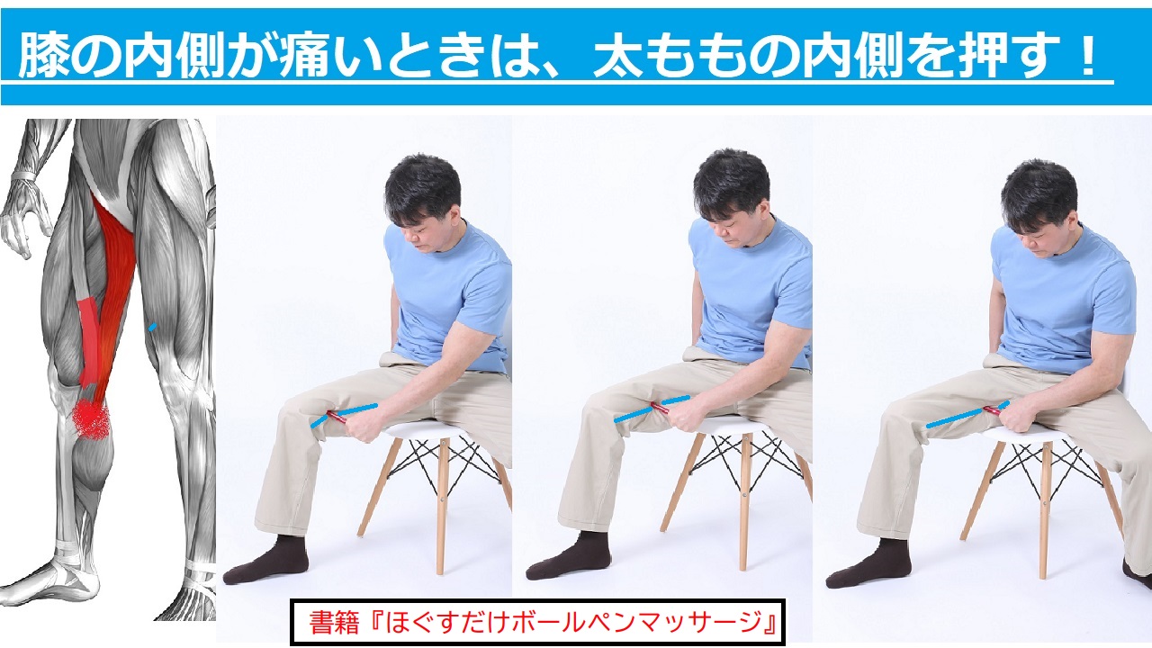 石部伸之 逆ストレッチ ボールペンマッサージ 膝の内側が痛い ランニング ウォーキングをした後に膝内側が痛くなったら ズボンの縫い目にそって ボールペンで内ももの筋肉を押しましょう 膝を動かす筋肉のコリがほぐれたら 即 痛みが和らぐこと 石部伸之 逆ストレッチ ボールペンマッサージ 膝の内側が痛い ランニング ウォーキングをした後に膝内側が痛くなったら ズボンの縫い目にそって ボールペンで内ももの筋肉を押しましょう 膝を動かす筋肉のコリがほぐれたら 即 痛みが和らぐこと