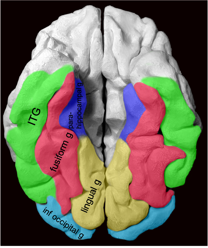 Gyral anatomy of inf occipitotemporal surface: The inf. temp. gyrus wraps from lateralinferior. The fusiform and lingual gyri span from occipital lobe posteriorly to temporal lobe anteriorly. Parahippocampal is medial temporal (anterior continuation of the lingual g).6/13