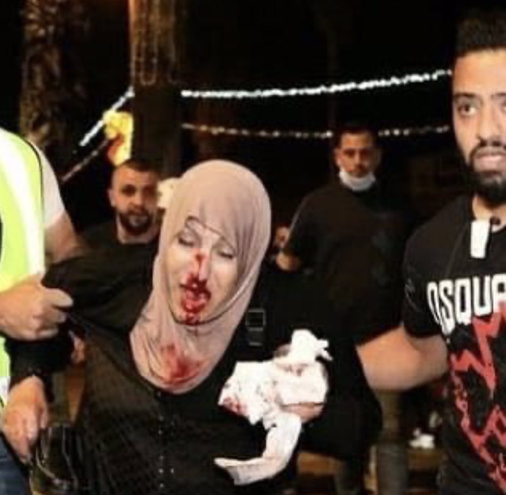 HrnYurdakul's tweet photo. Filistin’den  Kudüs’ten gelen son ajans fotoları anneler gününde.Elleriniz kırılsın.. https://t.co/bBPIq6ROJP