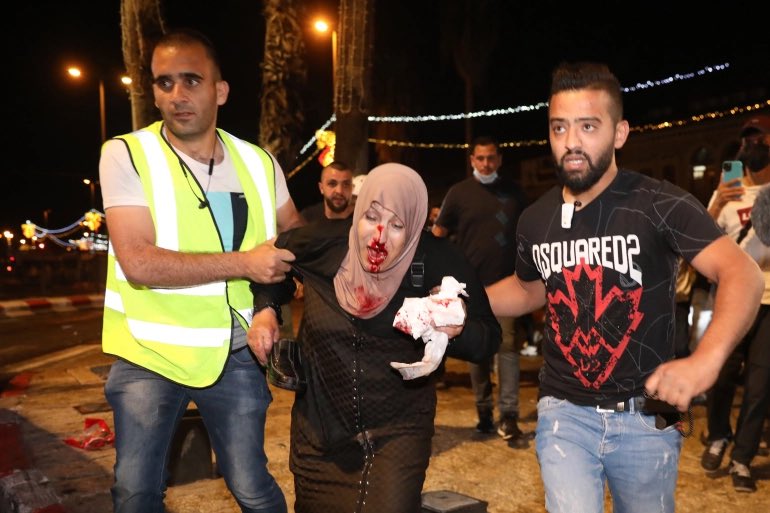 ArbeloNoel's tweet photo. in the first picture we have colombian police using violent unnecessary force against street protestors, and in the second we have a palestinian women being helped away after injuries from altercation at a protest..i pray for freedom and safety to all in colombia and palestine🤲🏽 https://t.co/JmYrm08EGy