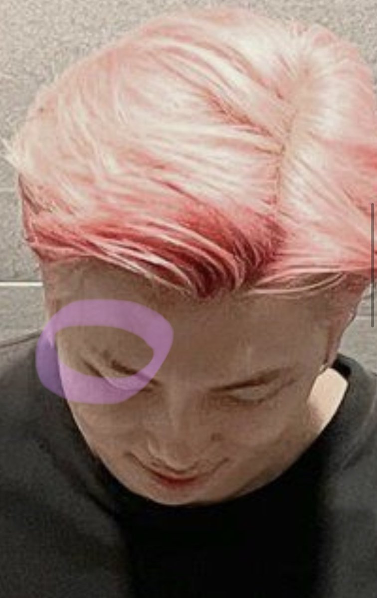 OP: Wow Namjoon oppa, did you get an eyebrow scratch (an eyebrow slit)?..daebak… no I just scratched it and it came off..* the closeup is mine @BTS_twt  #BTS    #방탄소년단  