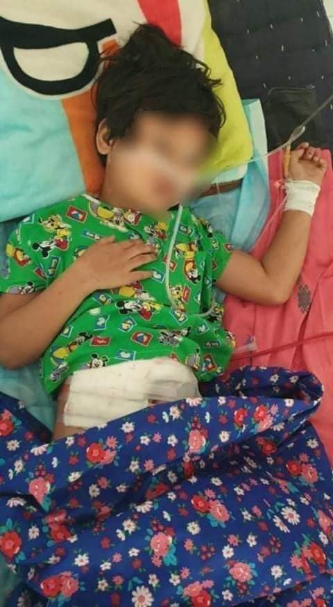 Nan Hom Noon, a little kid from Mandalay, is facing a life and death situation after taking a collateral damage from heavy artillery by the SAC forces. Donors are pouring in for her recovery.
#WhatsHappeningInMyanmar 
#May9Coup
#NoFlyZoneInMyanmar