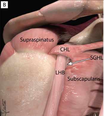 MskRoom1's tweet photo. Awaiting the release of our Msk Ultrasound book, here is another appetizer:
Evaluation of the rotator interval in the transverse axis.
If you want to be notified when the book is available, please register at:
https://t.co/dh6QuzL4ly https://t.co/IHCbkIaL6O