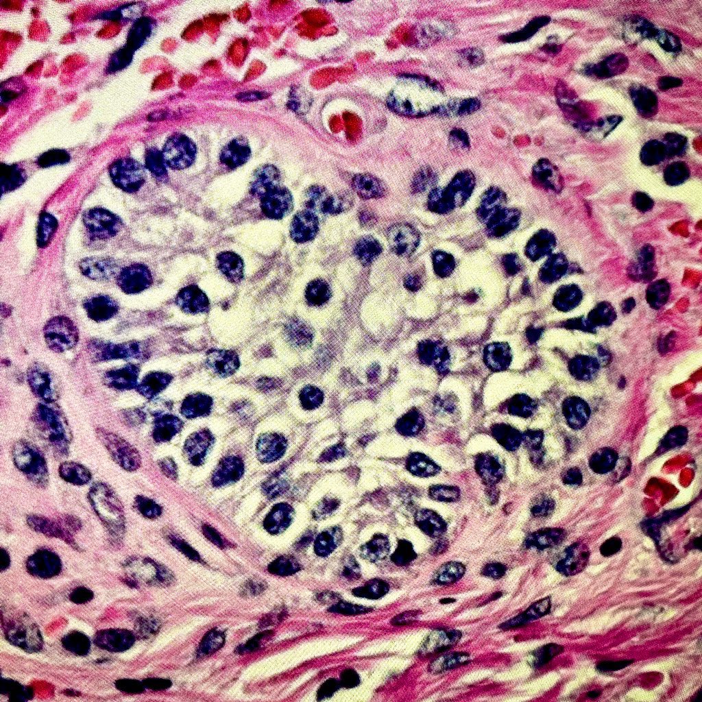 vetpathnerd's tweet image. #HappyMothersDay #Pathart #OvarianPath