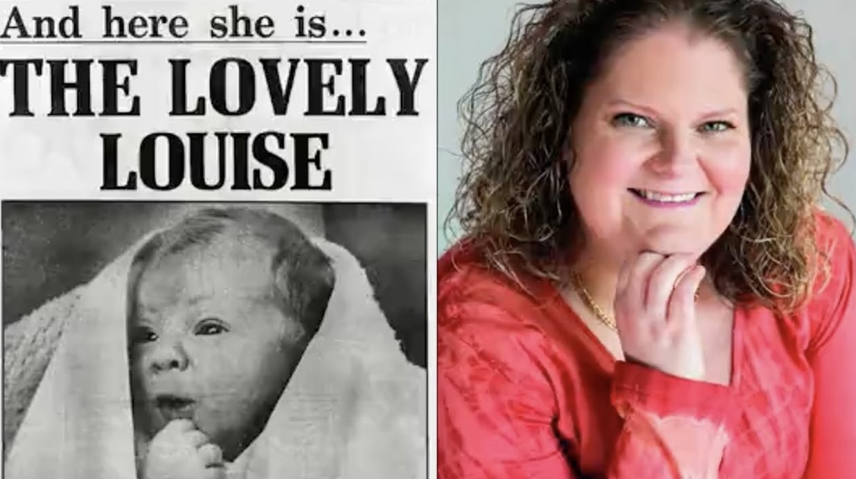 Today in Science History: In 1978, the world s first baby conceived via IVF was born. Happy Birthday Louise Brown! 