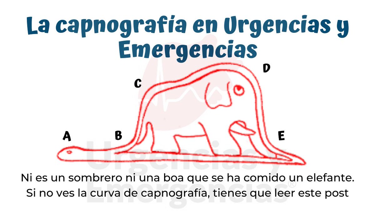 urgenciasemerge's tweet photo. ¿Qué es la #capnografía? ¿Qué aplicaciones tiene la capnografía en #urgencias y #emergencias? ¿Y en la #RCP? 
Pasa, y te lo cuento https://t.co/tZsd1siCzE https://t.co/OyziZ5d2dy