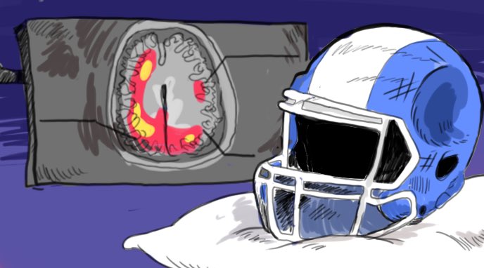 fucar001's tweet photo. How is it possible that even with the new technology, various research and many cases in sport-related sports like football, suspected and confirm concussions on athletes are rising, and worst that 50-80% of all sport-related mTBIs go unreported? @ElissaMMonteiro #ucr150 https://t.co/AADwYmjdoq